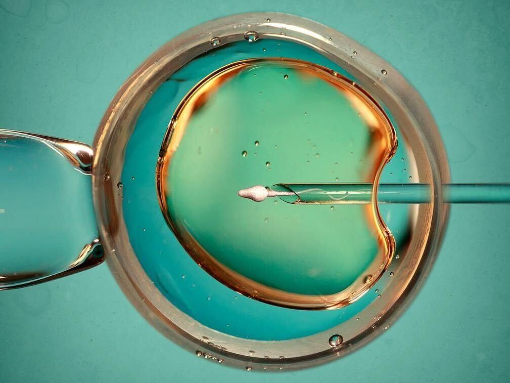 Donor Eggs Essential For Successful IVF  After 40, Study Finds